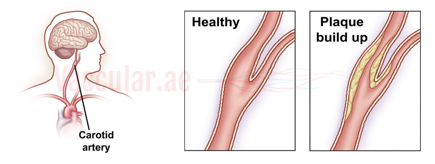 Maintain a healthy vascular system