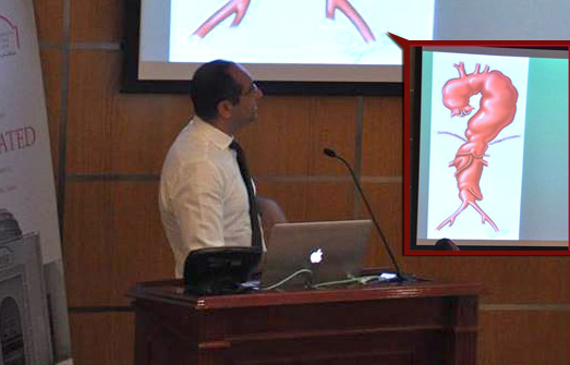 Endovascular Revolution in Vascular Surgery : Coffee Morning at UHS