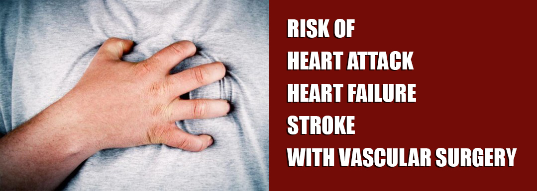 Risk of Heart Attack / Heart Failure / Stroke with Vascular Surgery