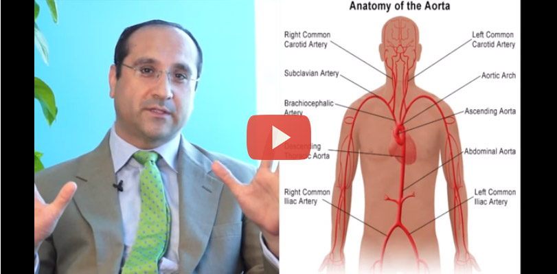 Aortic Aneurysm – Symptoms and Treatments