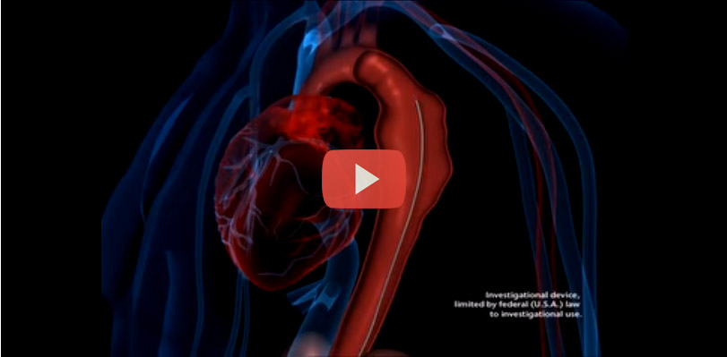 Thoracic Aortic Aneurysm Treatment