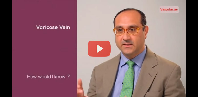 Varicose Vein and Minimally invasive Treatment